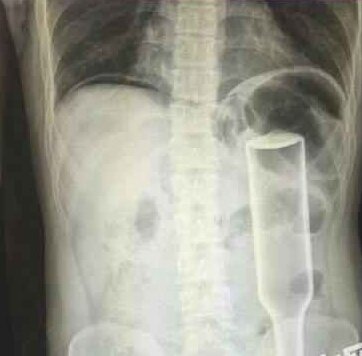 【娱乐】折腾到联合国也不怕?